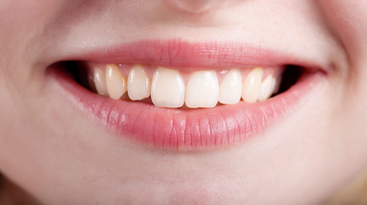 Denti bianchi - Lineadiretta24.it