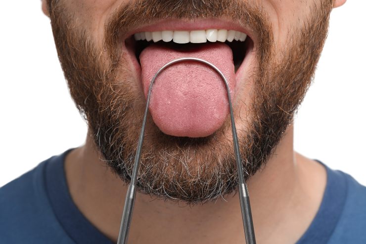 Di che colore è la tua lingua? Tienila sott'occhio prima che sia troppo