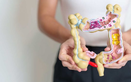 Cancro all'intestino - fonte_Canva - lineadiretta24.it